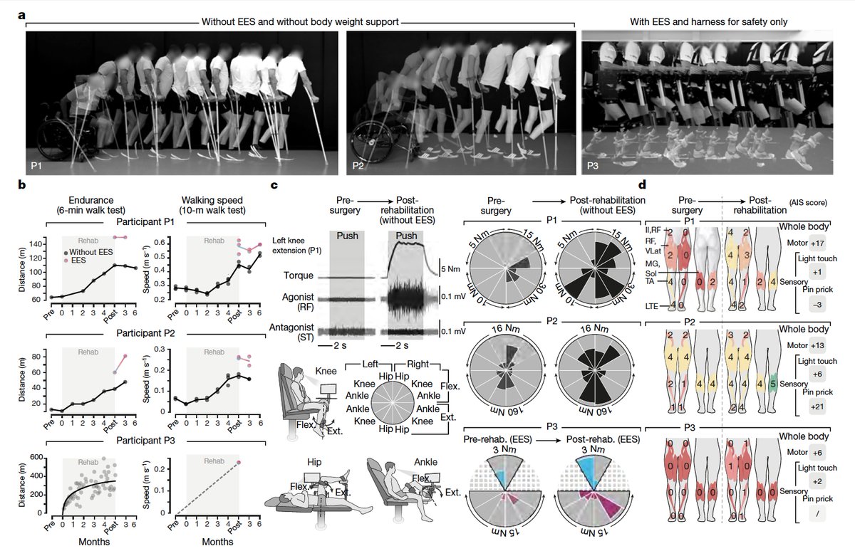 EricTopol's tweet photo. Using targeted and timed neuro-stimulation to enable walking after (even years later) spinal cord paralysis, representing exceptional work @EPFL @EPFL_en @Nature @NatureNeuro @gcourtine and colleagues
https://t.co/vQ4krg8fYd
https://t.co/MYtBlLa0Hb https://t.co/bdSs73BDpH