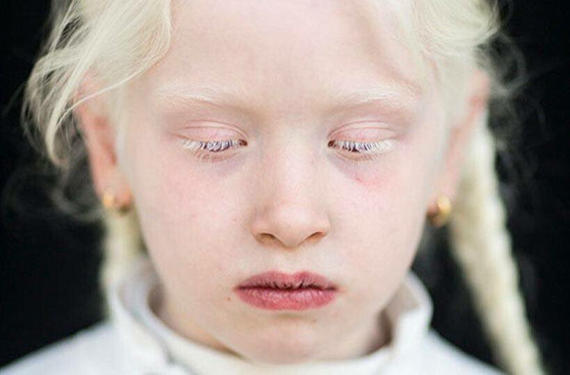 Museum of Humanity vanaf vandaag te zien in de Balie!

buff.ly/2CSADeH