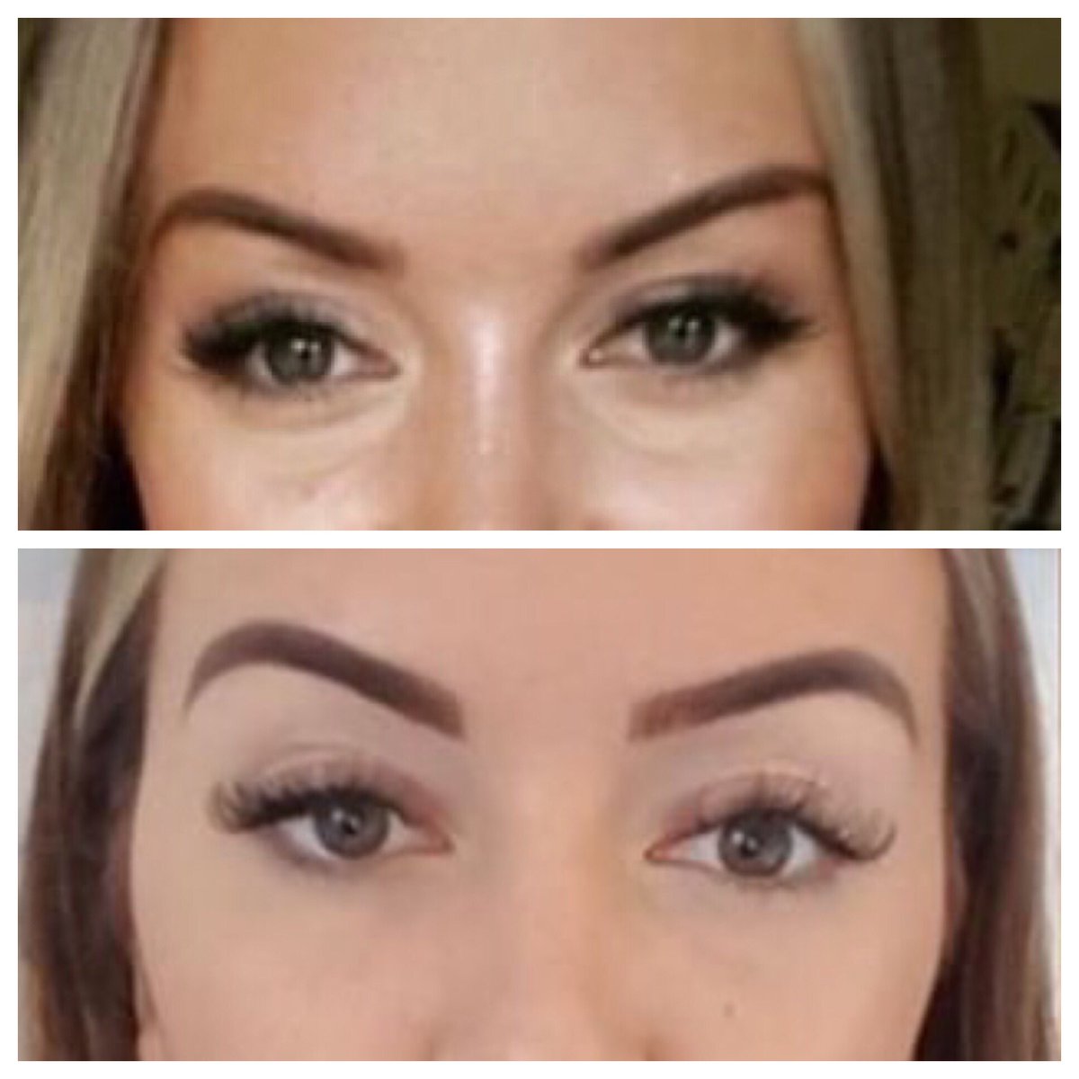 MrIanMorgan's tweet photo. ✨ Eye Trough Fillers for £200 ✨

Restores lost volume and reduces the apperence of dark circles. Our client was thrilled with her results, “The best money I’ve ever spent!”

Call: 01543 572838 to arrange an appointment https://t.co/DFhGsVm0Yi