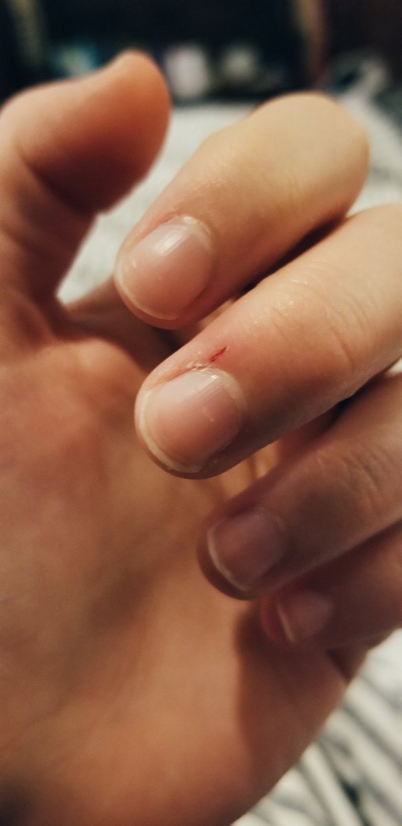 rachelcann's tweet photo. Ouch?? How is something so small SO PAINFUL plz call 911 https://t.co/fD6rUM3qCs
