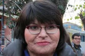 Carmen Gloria Quintana es el mayor TONGO en la historia d´Chile Un soldado confesó q´fue quien pateó casualmente 1 de las bombas q´llevaba esta extremista Años mintiendo y culpando a inocentes !

<a href="/samyaboid/">Antonio S.A.A.C.</a> <a href="/sergioulloa1/">Una nueva consciencia</a> @CoquiAngelica <a href="/warhawk2274/">Hawker Hurricane 🇨🇱</a> @GLORIAHAUSDORF <a href="/LATI5910/">@LATI5910</a>