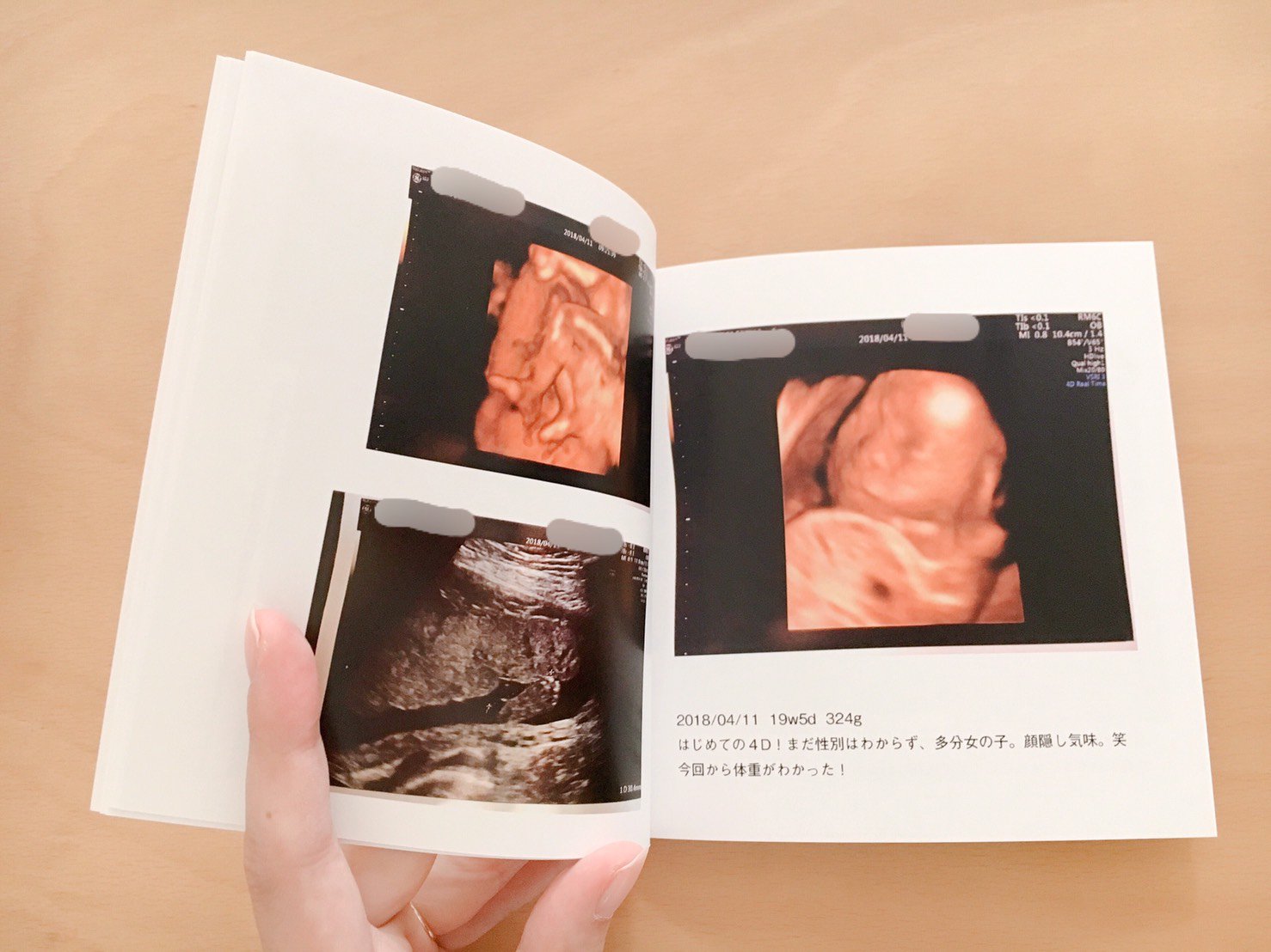しまうまプリント En Twitter エコー写真をフォトブックにする方 増えているような気がします マタニティフォトと一緒の作品にしても Twitter