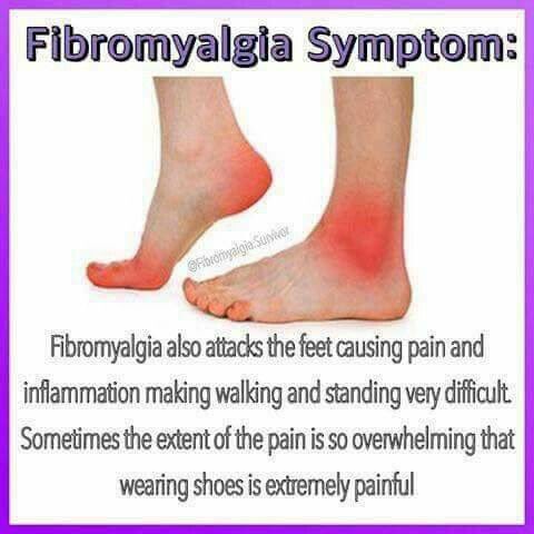 mjr73's tweet photo. This is one of the symptoms I struggle with the most, finding shoes isn't straight forward! #invisibleillness #fibromialgia #learningtocope https://t.co/SoqLymFqkg