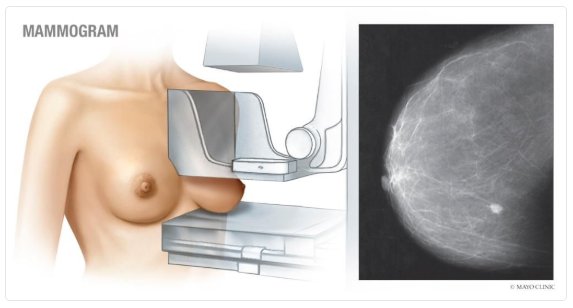MayoCancerCare's tweet photo. It's National #BreastCancerAwarenessMonth. If you're due for a #mammogram, should you opt for an imaging test that creates a three-dimensional picture of the breast? https://t.co/bjTtivxuwh #bcsm #BreastCancer https://t.co/VUm7vDs88I