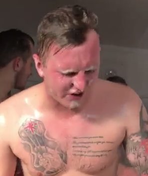 OfficialBeesFC's tweet image. Burntwood FC and all players associated with the team would like to send their best wishes to keeper Jamie Denton who may never see again. 

#JeSuisJamiesEyes