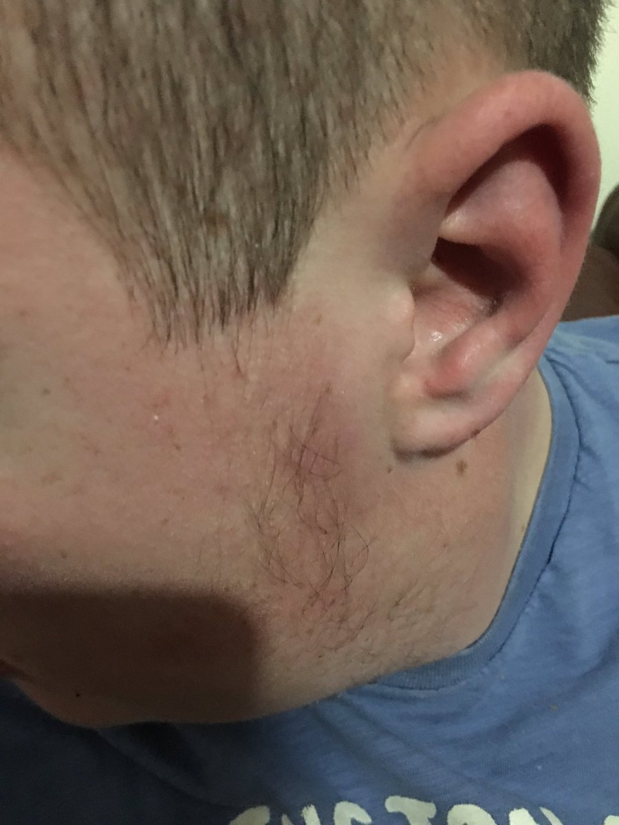 TinaBetts9's tweet image. Autism boy my son gets beaten up at train station police do nothing