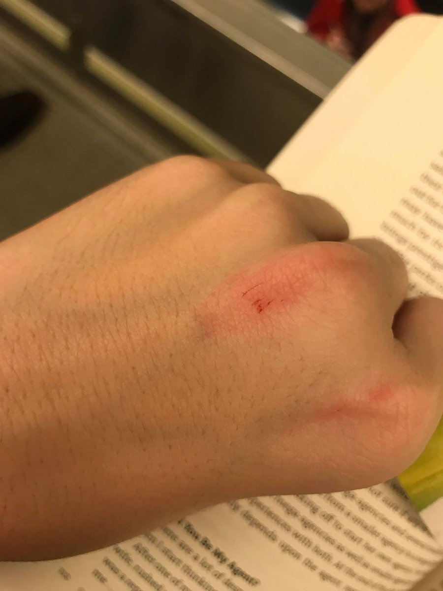 HairTrigger20's tweet image. The power of paper. 😩😂 #papercuts #editorprobs #readingprobs @Twatmehere