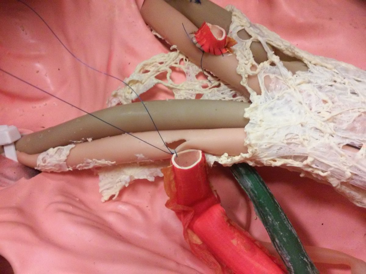 CursoTxThiel's tweet photo. #TxThiel vascular hands-on workshop. Practicing termino-lateral vascular anastomosis on silicone model. Photos from #TxThiel15 https://t.co/bH16qN3bHi