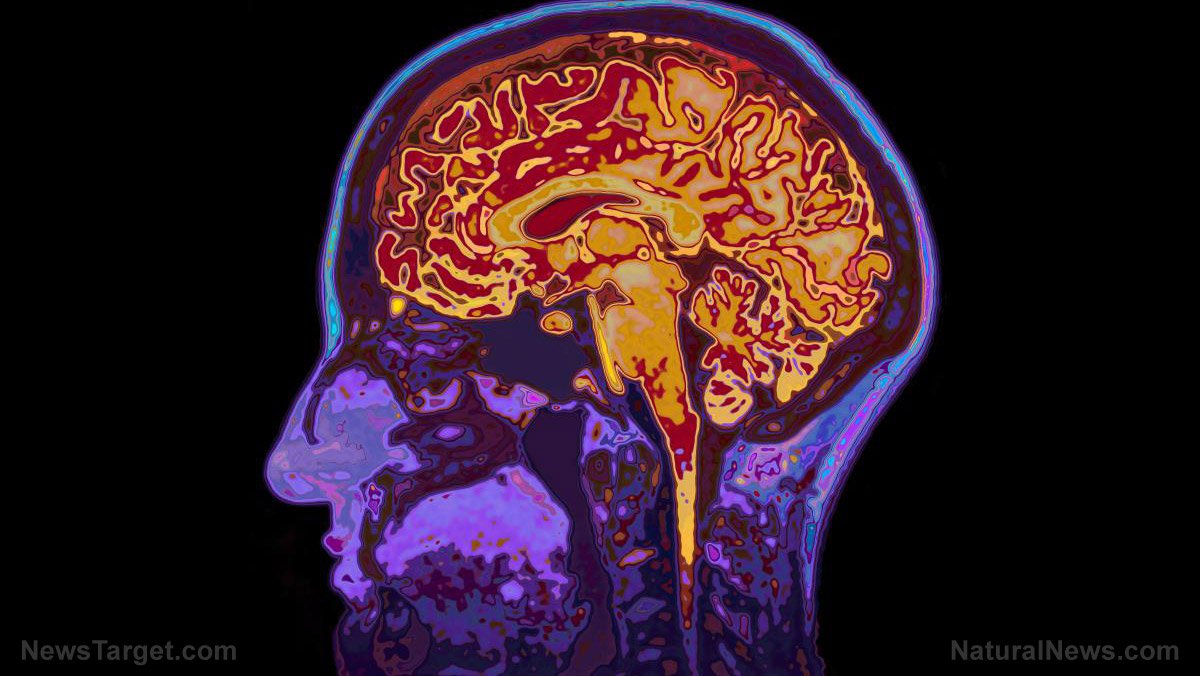 SGTreport's tweet photo. New post Scientists STUNNED as first-of-its-kind study reveals strong link between ... has been published on S ... - https://t.co/Vxha4d0egF https://t.co/My9rniaSmI