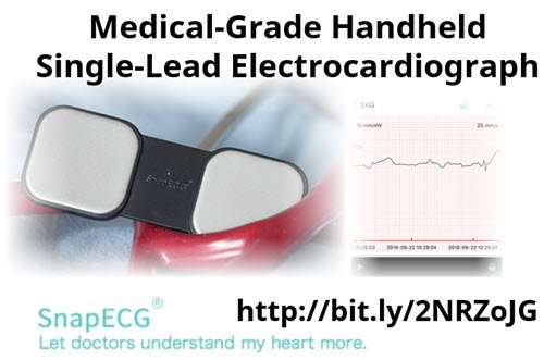 MedGizmo's tweet image. SnapECG Medical-Grade Handheld Single-Lead #Electrocardiograph bit.ly/2NRZoJG #hearthealth #HeartRate #healthmonitoring #digitalmed #Afib #HealthIT #medtech #meddevice