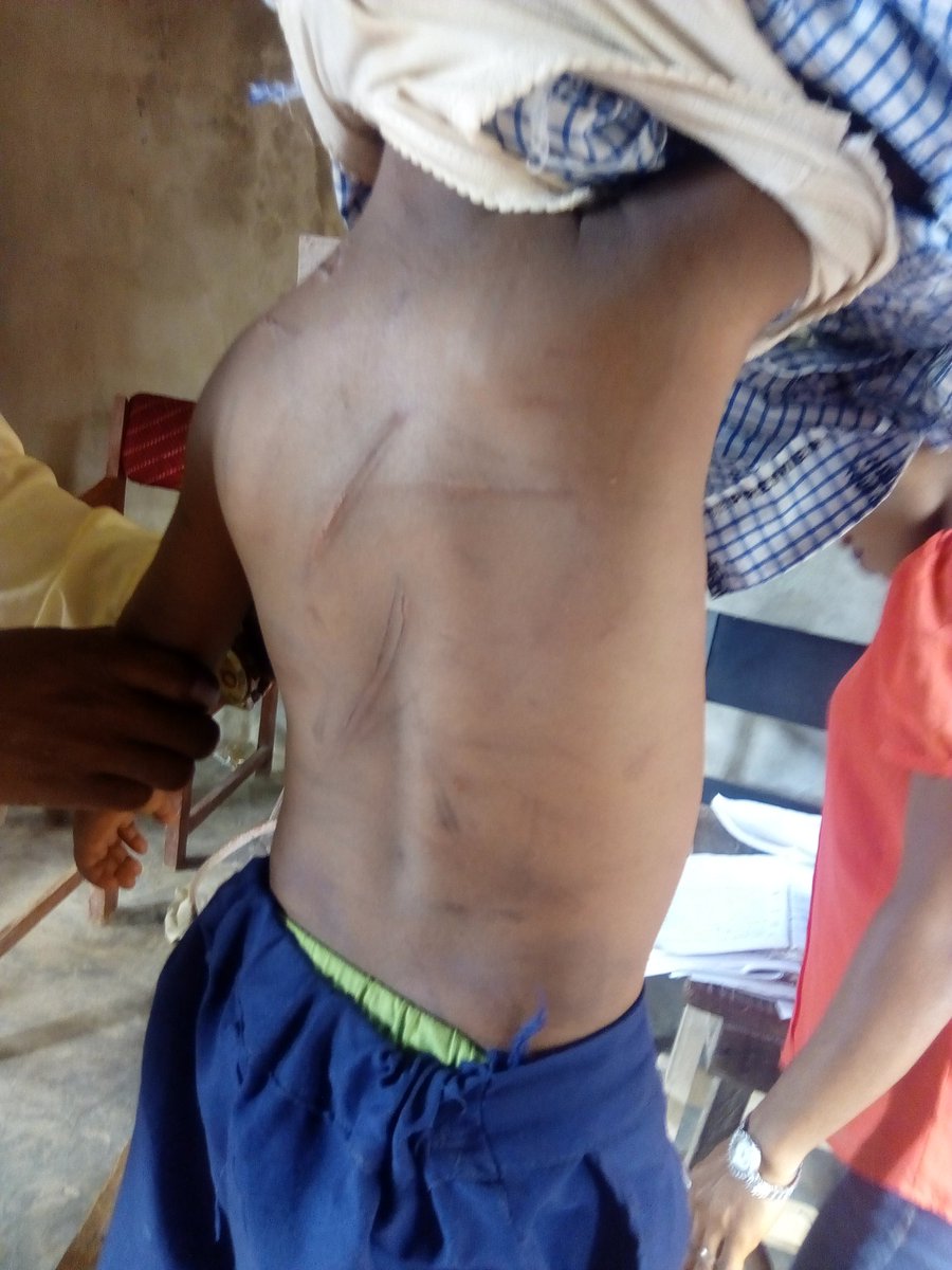 b_hability's tweet photo. #justiceformicheal #justiceformicheal
This is Micheal,a pupil of K.G 1 that is not even up to 4yr was cruelly beaten by his guardian,he has been going through this for a while.Twitfam let's get justice for Micheal  @segalink @OgbeniDipo @DrJoeAbah @eleniyan25 @Bhadoosky https://t.co/QWxcbZxZdU