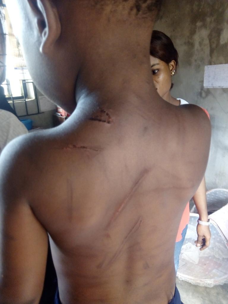 b_hability's tweet photo. #justiceformicheal #justiceformicheal
This is Micheal,a pupil of K.G 1 that is not even up to 4yr was cruelly beaten by his guardian,he has been going through this for a while.Twitfam let's get justice for Micheal  @segalink @OgbeniDipo @DrJoeAbah @eleniyan25 @Bhadoosky https://t.co/QWxcbZxZdU
