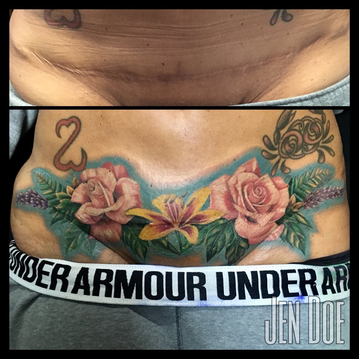 Jen Doe on Twitter Scar cover up  tattoo art scarcamouflage chicago  flowers femaletattooer tattooartist httpstcoRVlO70jZTO  Twitter