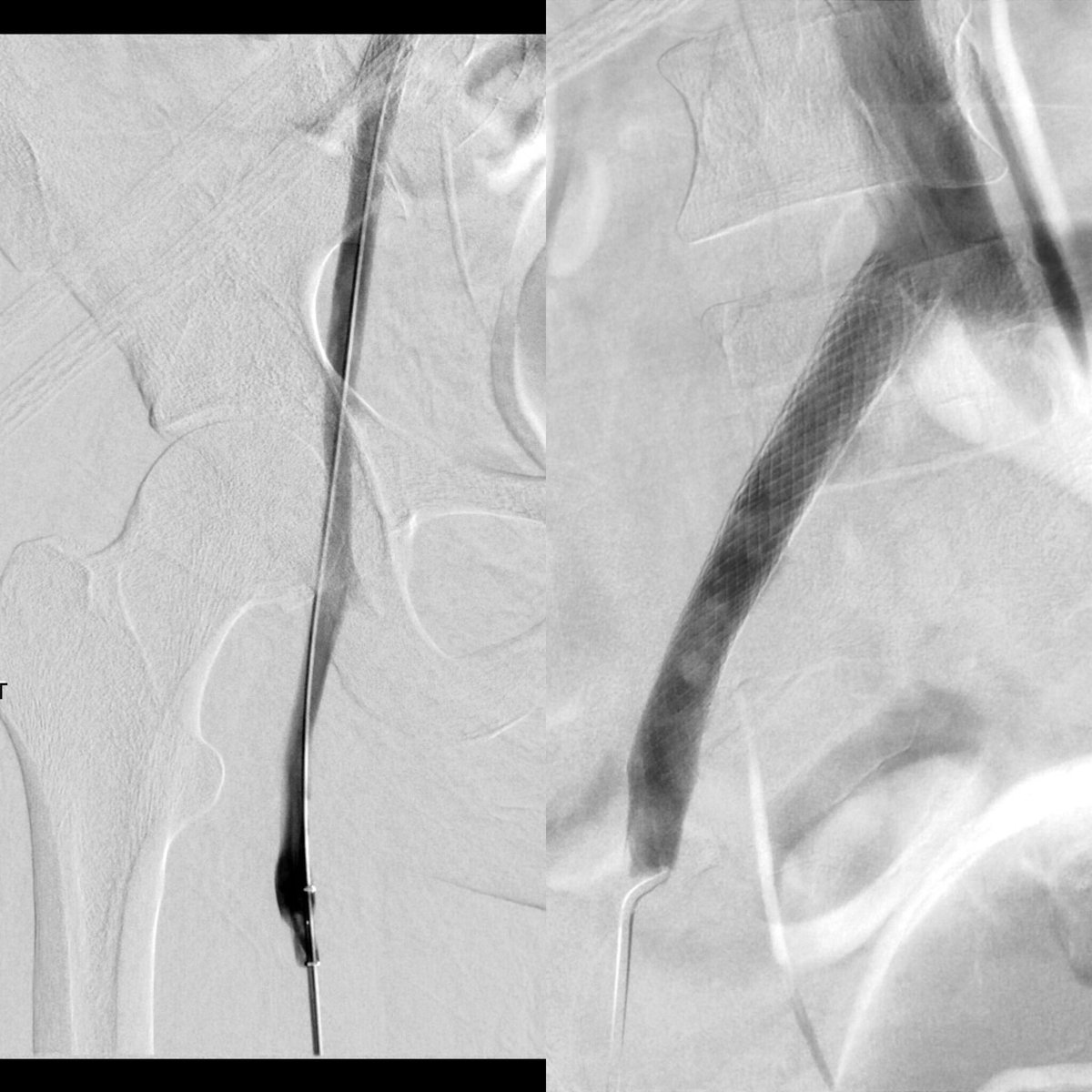 Albany IR tweet media