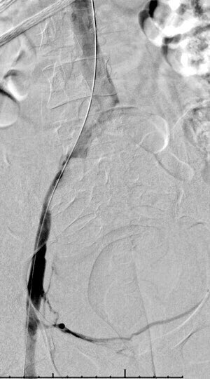 Albany IR tweet media