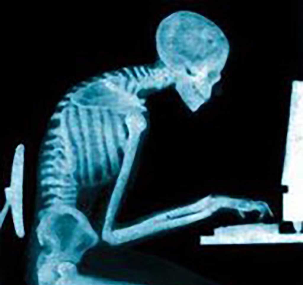 Fullflamephysio's tweet photo. Do you work at a computer all day and could this be you? Mind your posture! Book in for an assessment. #Posture #Injuryatwork #Office #MondayMotivation #neckpain #BackPain https://t.co/RYVNwBLaOX