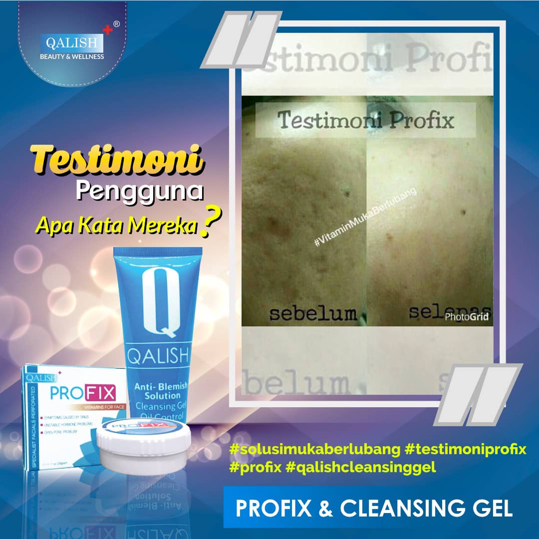 QalishProfix1's tweet photo. Mahukah anda mengucapkn SELAMAT TINGGAL kepada masalah jerawat,jeragat dan parut yg melampau ??
#BeliQalishMenangTOYOTACHR #testimoniprofix #NO1TrustedSkinSolutionMalaysia #IAMQalishian #QalishTurnThree #ILOVEMYQalishian #QalishLover #SayaJutawanQalish #azizanosman #SifuFbAds https://t.co/MHQUEjpss9