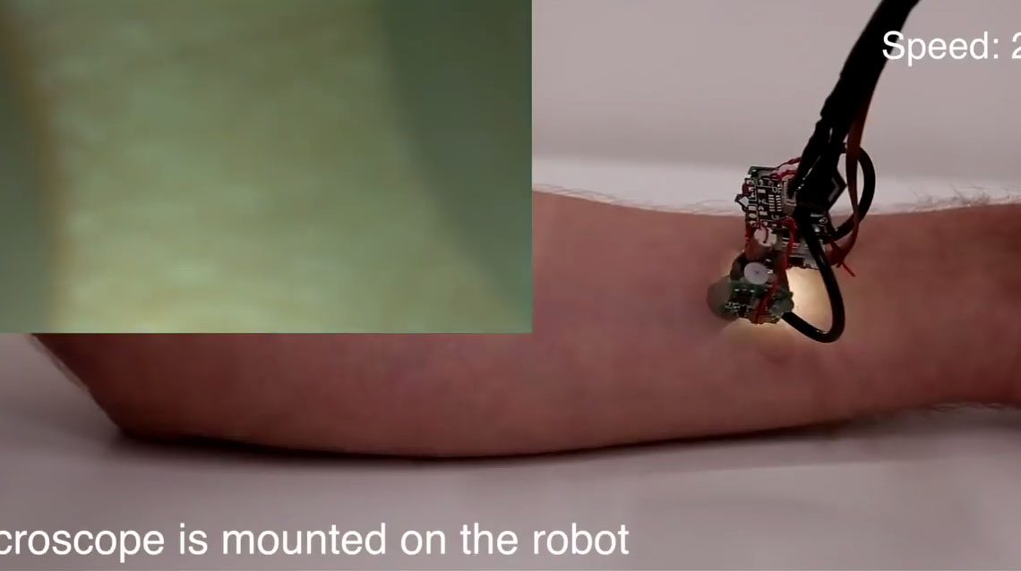 .<a href="/mit/">Massachusetts Institute of Technology (MIT)</a>'s Skinbot can map your #body, looking for any ailments robotschampion.com/skinbot-will-m…