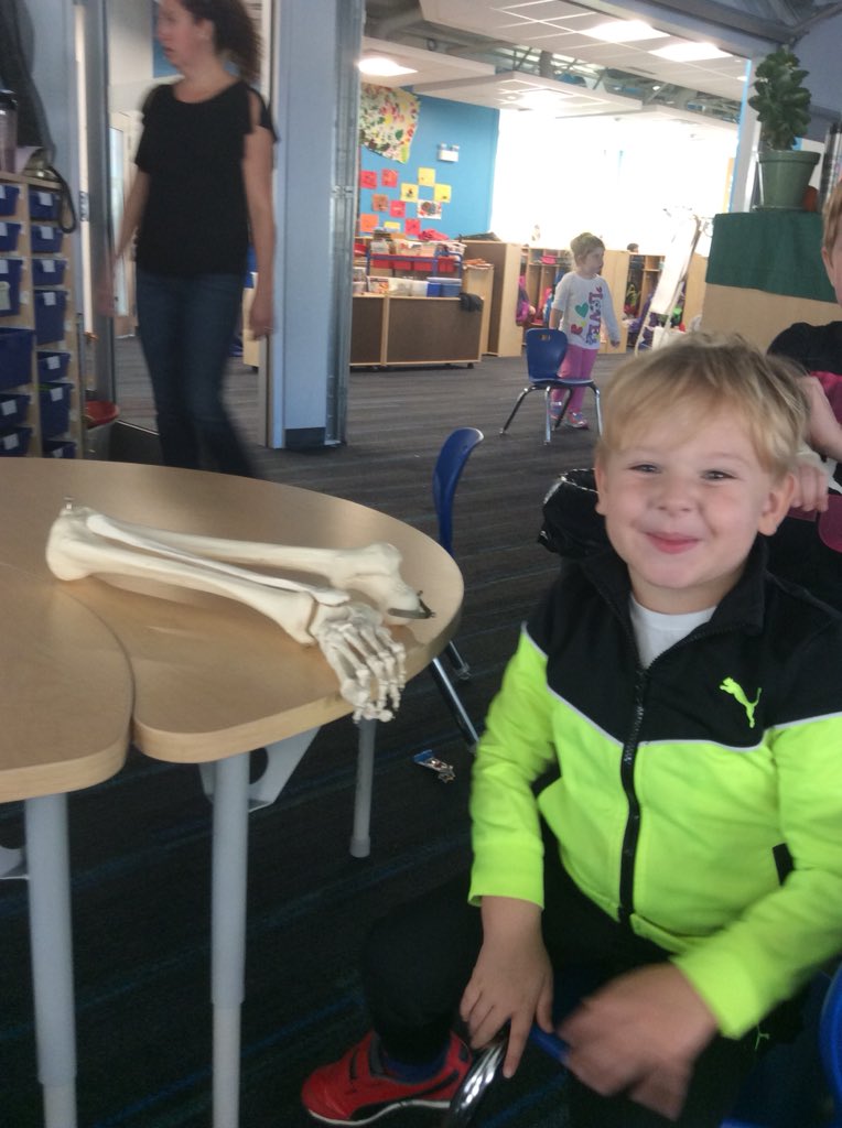 somers_smith's tweet photo. Kinder Community Visitors: we learned how broken bones are x-rayed, cared for, and heal.  Thank you Mr. Anderson and Emily! @alcdsb_stfa @K_2Wolfpack https://t.co/Q4UzRMDwYy