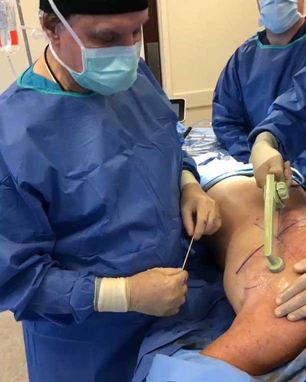 DrRodRohrich's tweet photo. Emerging role of #radiofrequencybodycontouring with #bodytite @inmodeaesthetics key #safetyprinciples #bodycontouring @rod.rohrich @erez_dayan_md #plasticsurgery @dallascosmeticdallasrhino #liposuction #dallasplasticsurgeryinstituterjr #patientsafe… https://t.co/OH2bpJa4Eq https://t.co/UnZchLvm1P