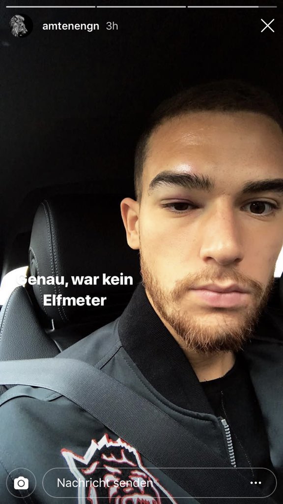 kilian_ga's tweet photo. #MSV-Profi Ahmet #Engin zeigt sich mit dicker Beule bei Instagram. Er schreibt: “Genau, war kein Elfmeter”. Es geht um den Zweikampf mit Jeremy #Dudziak im Pauli-Strafraum. Sein Bein traf Engin im Gesicht. #msvfcsp https://t.co/szsCp8yfCb