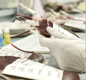 edqm_news's tweet image. In Europe, millions of units of blood and blood components are collected annually. Statistical Process Control (SPC) is key to ensuring that each process in the supply of #blood is in control and achieves desired result.
bit.ly/2tFcr7a
#statistical_methods #SPC #blood