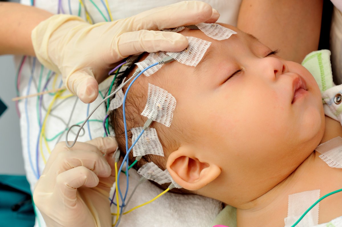 Neonatal Neurology: Dr. Dudink tweet media