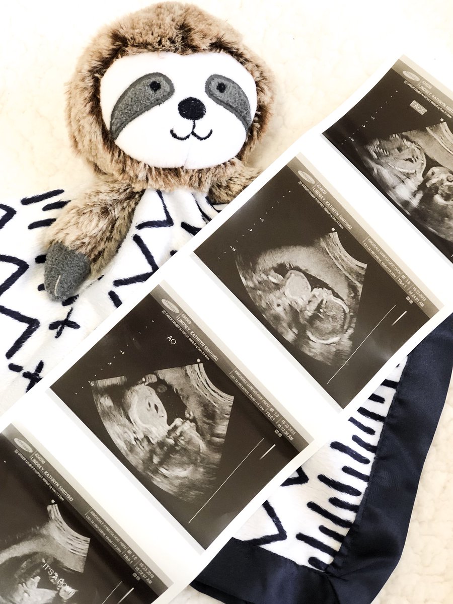 katelindsey's tweet image. 19 weeks, big lips, above average weight, long legs, &amp;amp; wouldn't let us look at his face because he was too busy snuggling with himself... definitely our child 💙
•••
#almosthalfway #anatomyscan #BookerGordon #BabyBowen #PleaseDontComeOutElevenPoundsLikeYourDaddy