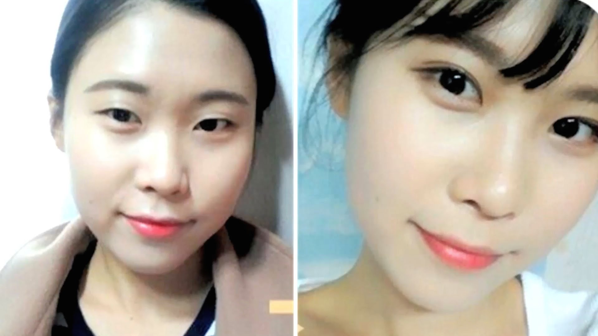 The most popular plastic surgery in S. Korea is a blepharoplasty which, you...