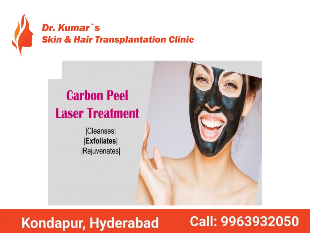 drashokkumar143's tweet image. Carbon Peel Laser Treatment in Hyderabad
thehaircare.co.in
Best Skin Care Treatment in Hyderabad
#Carbon_Peel_Laser_Treatment
#Skin_Care_Treatment
#Hair_Transplantation