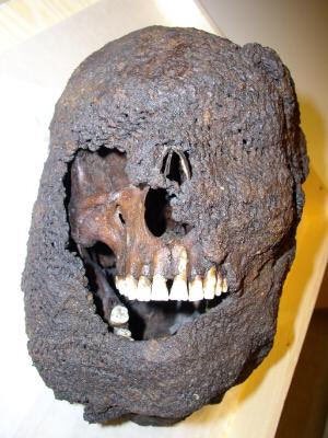 Skull of a Gutnish soldier found wearing medieval chainmail. The Battle of Visby was fought July 27th, 1361 near the town of Visby on the island of Gotland, Sweden, between the forces