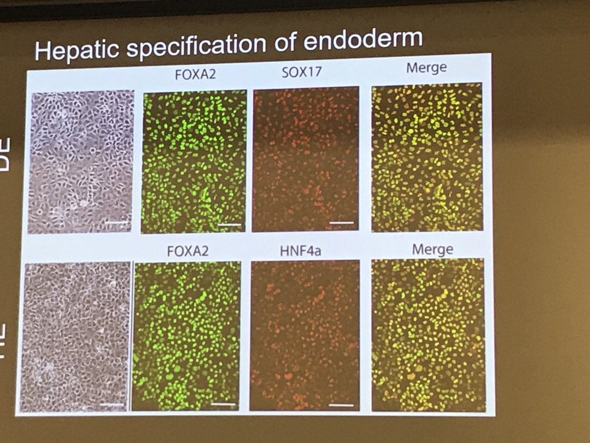 DrRosenIBD's tweet photo. #NASPGHAN18 Preview: @CincyChildrens Aki Asai, @NASPGHAN George Ferry Young Inv Award Recipient, rehearses his fascinating Sat a.m. talk: Engineering human liver #organoids for modeling of inherited cholestasis. #DrugDiscovery #HumanModels #Research https://t.co/tThdpFwCF3
