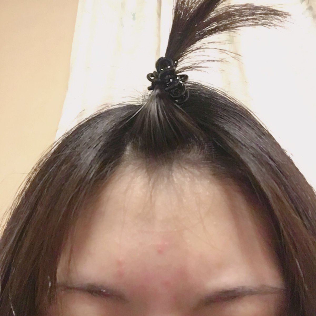 小チャハン おでこに思春期かよってくらいニキビが出来ているので 今日は前髪を上げて寝ます T Co Eoqkgnpvxm Twitter 小チャハン おでこに思春期かよってくらいニキビが出来ているので 今日は前髪を上げて寝ます T Co Eoqkgnpvxm Twitter