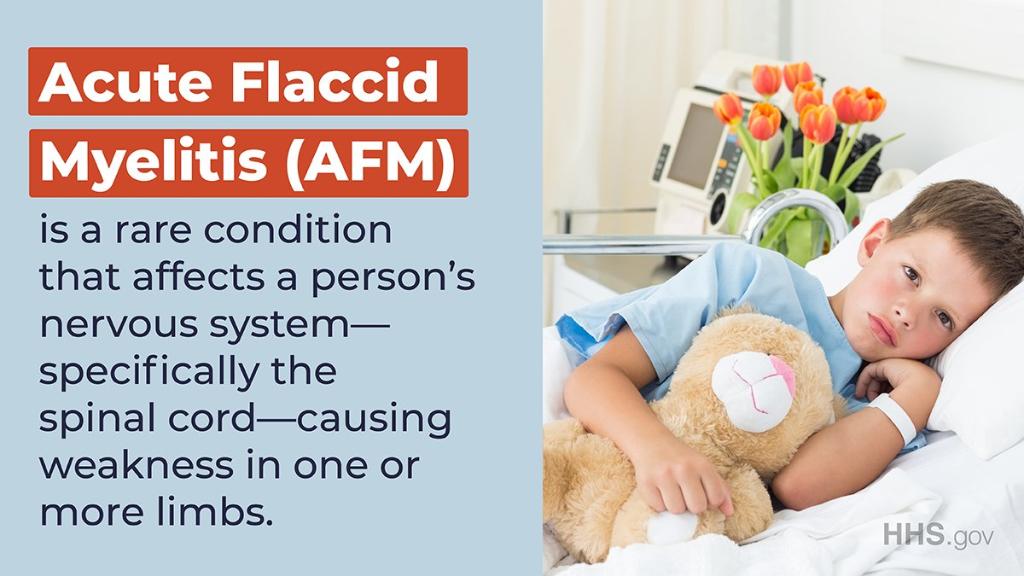 Acute Flaccid Myelitis