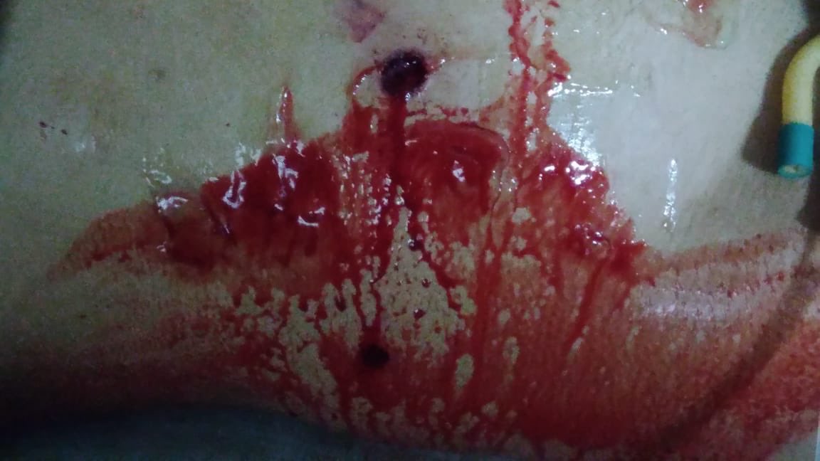 DrHarjitBhatti's tweet photo. Medical student shot by outsiders near campus of UPUMS, Safai, UP in an attempt to loot motorcycle. Hospitals &amp; Medical Colleges are the most vulnerable places, There is no security for us. #StopViolenceAgainstDoctors #ZeroToleranceToViolence #DoctorsAreAlsoHumans https://t.co/DGgL1o768B
