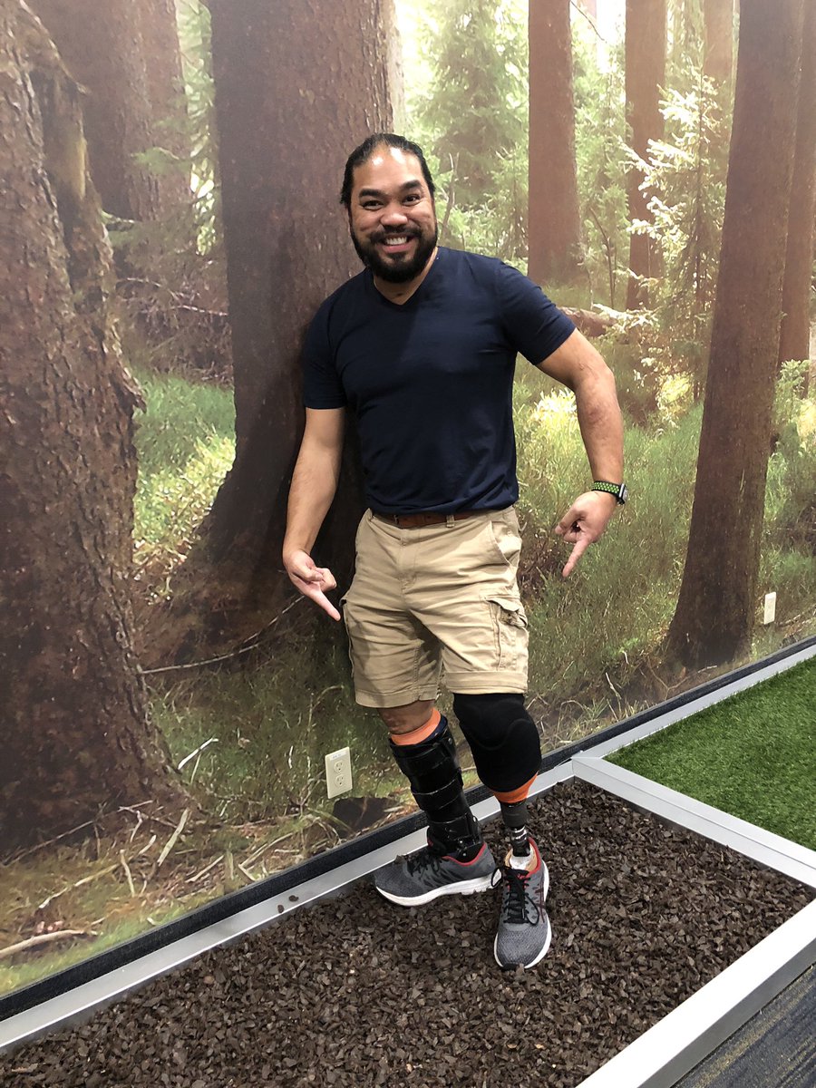 ampu_to's tweet photo. Spent the day at @OttobockUS_CA testing out the Harmony P4 Vacuum Socket System with the Triton foot. Do I switch to a vacuum? 🤔☺️ #intrigued #patientmodel #amputeelife https://t.co/1lRVPHHrsC