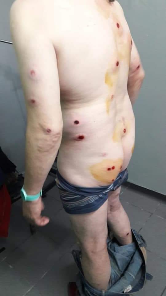 canoarthur's tweet image. Represión policial a los manifestantes esto no puede seguir así por pedir la transparencia Municipal en concepción.