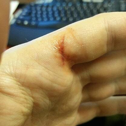 brentdahldesign's tweet photo. 3D printing isn't always fun. Especially if you slip when prying off a print. #3dprinterfail, #ouch https://t.co/7ev4WqAa5M https://t.co/yEYSk51qe4