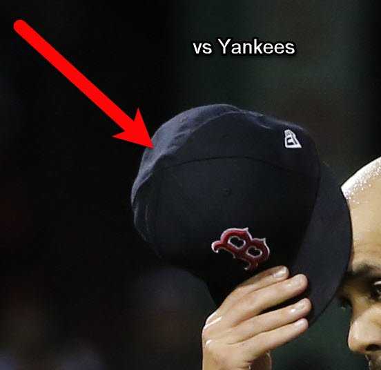 baseball cap squatchee replacement