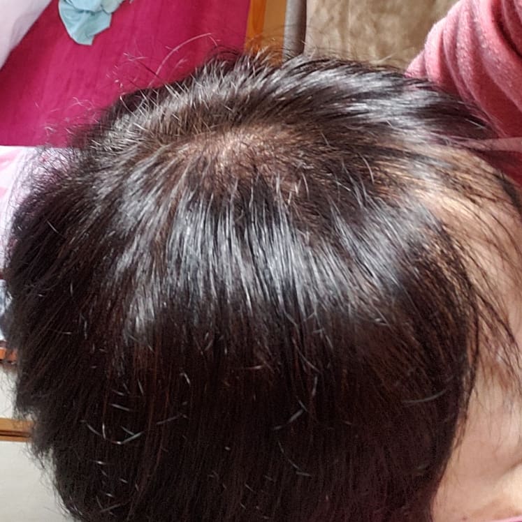 Hiromi シルバーヘア計画始めます 魔女化計画とも言う 昨日は 刺激の少ないカラー材で染めてもらいました 約3週間後には 白髪部分が現れるはず 大事に伸ばすんだからね 真っ白かな それともごま塩グレーかな 楽しみすぎる 艶々グレイを Hiromi シルバーヘア計画始めます 魔女化計画とも言う 昨日は 刺激の少ないカラー材で染めてもらいました 約3週間後には 白髪部分が現れるはず 大事に伸ばすんだからね 真っ白かな それともごま塩グレーかな 楽しみすぎる 艶々グレイを