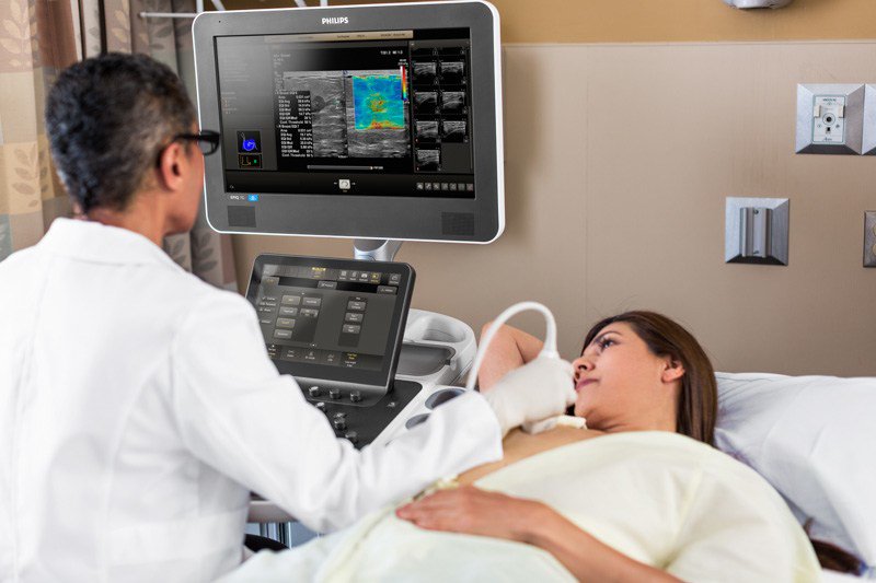 PhilipsPR's tweet photo. .@Philips debuts integrated breast ultrasound solution to make exams easier and faster for patients and clinicians https://t.co/k23cSefTKn https://t.co/xCbMr6Ph89