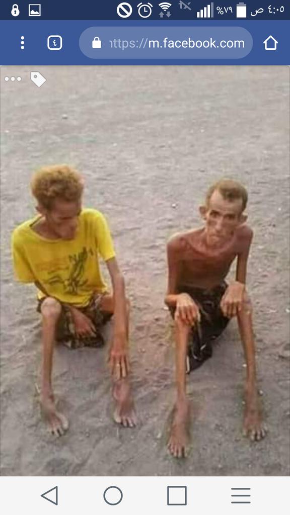 يا شعب #مصر العظيم حافظوا على جيشكم لأنه مصدر قوتكم و وحدتكم  و امانكم 
لو تعلمون كيف أصبح حال الشعب اليمني لأنه لم يكن يملك جيش برأس واحد 
#محمد_بن_سلمان 
#السيسي 
#القاهرة 
#الإسكندرية 
#سيناء 
#Egypt
