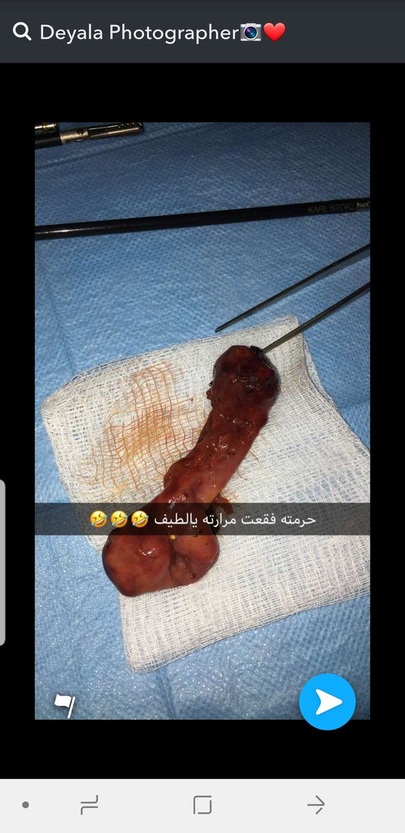 AgainAmina's tweet photo. @onlynona4 @DidaKsa شيء جميل إنك شاطرة بالتكنولوجيا، إذا كنتي أشطر مني ف هنيئا لك

أتمنى إنك تكوني بنفس المستوى على جميع الأصعدة على سبيل المثال تعرفي إيش أخلاقيات وآداب العمل للطبيب 
وماتنشري شي زي كذا 👌 https://t.co/ItnKV7LgER