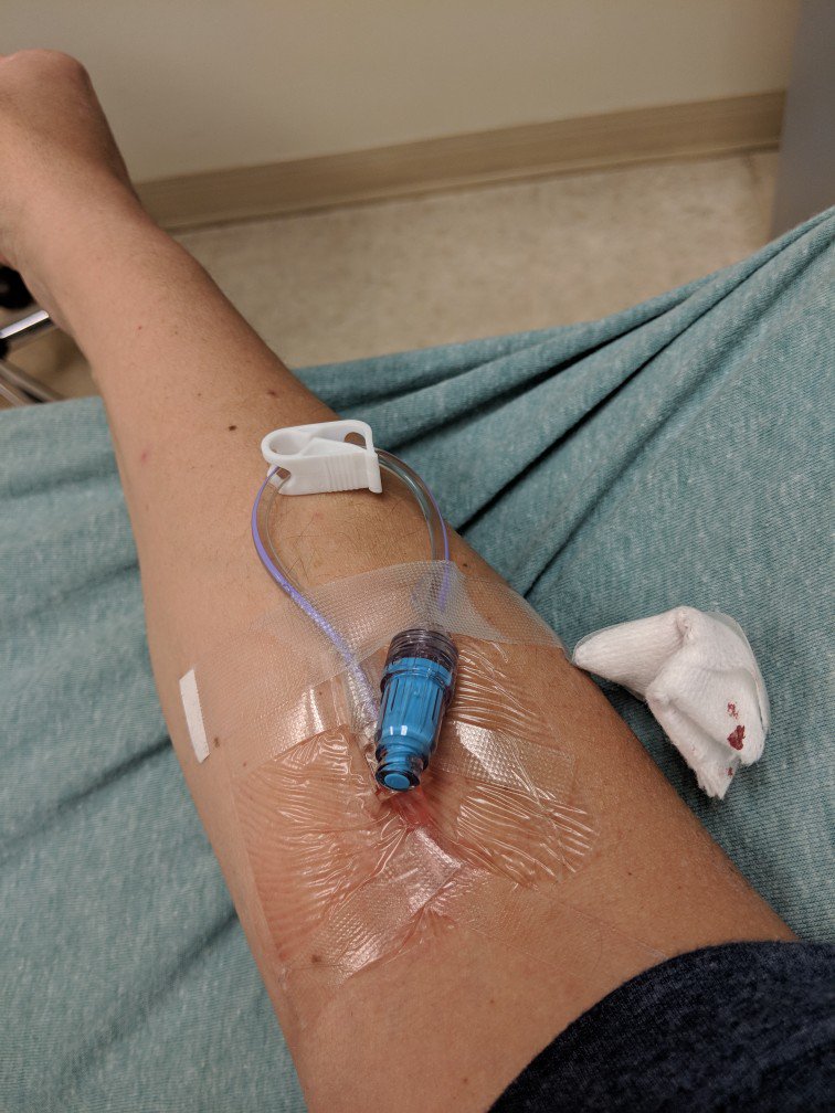 StepanieDrew25's tweet photo. Top 5 worse things about being in the hospital: Needles, tests, no @ReelzChannel , no @stevehelling  &amp;  no @Brad_Osborne 😣😷 https://t.co/pT2rhhZRBN