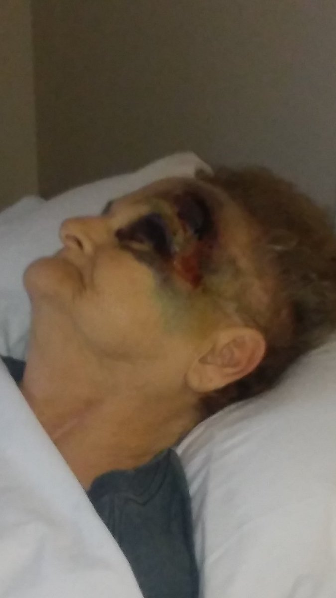 MichaelHillAtty's tweet photo. Just filed in a wrongful death lawsuit against a nursing home in Ohio (Pristine Senior Management) for a family whose mother was severely injured in a fall but never sent to the hospital. She showed clear signs of a head injury for 6 days before dying #endingnursinghomeabuse https://t.co/rvvSM0kM5U