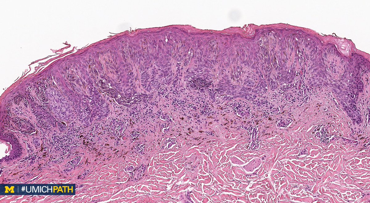 Shima Mousavi, MD (shima_mousavi) Twitter