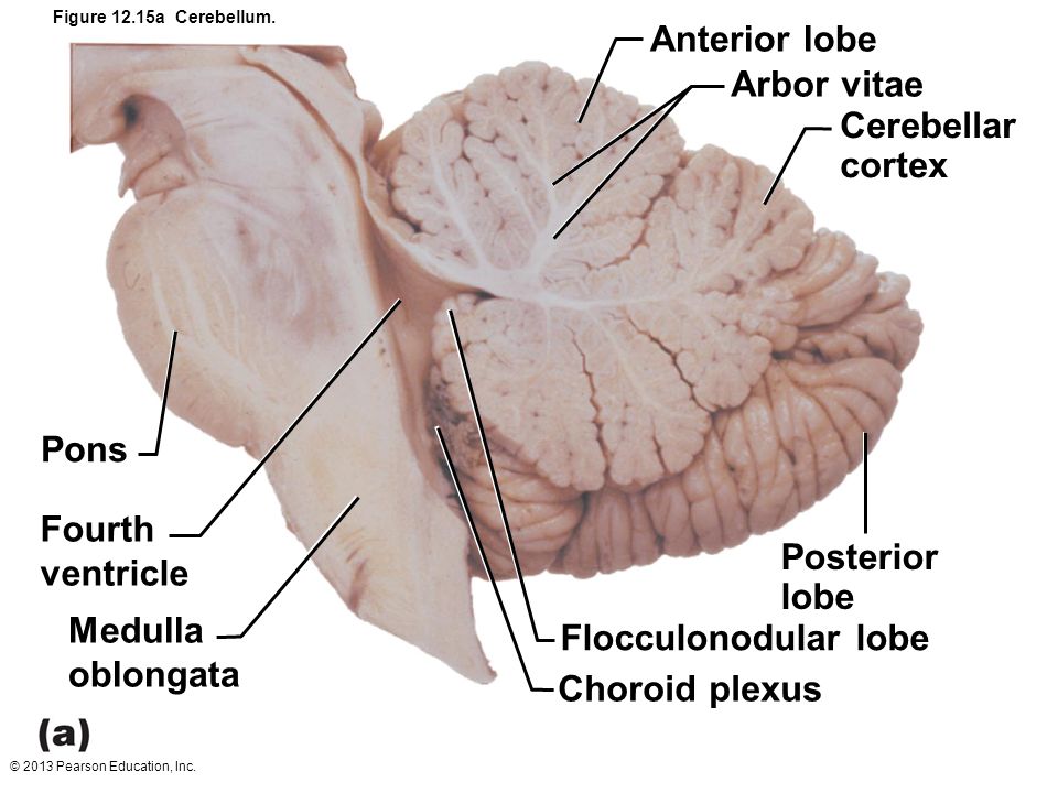 Cerebellum Arbor Vitae - Tree of Life. #Akashic  #Acacia  #Akasha  #Cerebellum