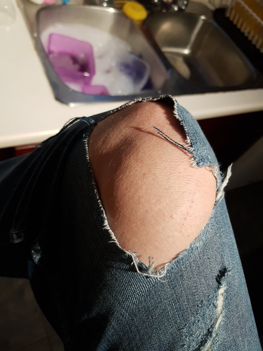gavinthomas2015's tweet image. Brand new Jean's ruined!! All because of a big toe!! #snagged #dayruined