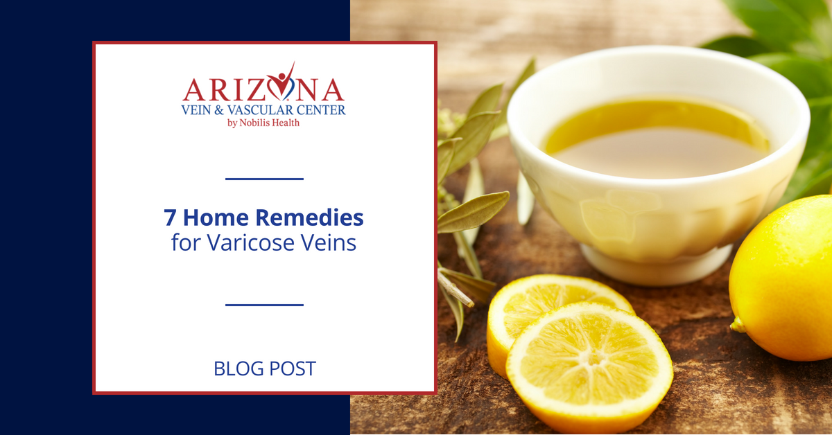 ArizonaVascular's tweet photo. Fortunately, there are some home remedies that can treat #varicose #veins without the need for surgical treatment. https://t.co/wALoQEqsQT https://t.co/Y4zjjkfdkh