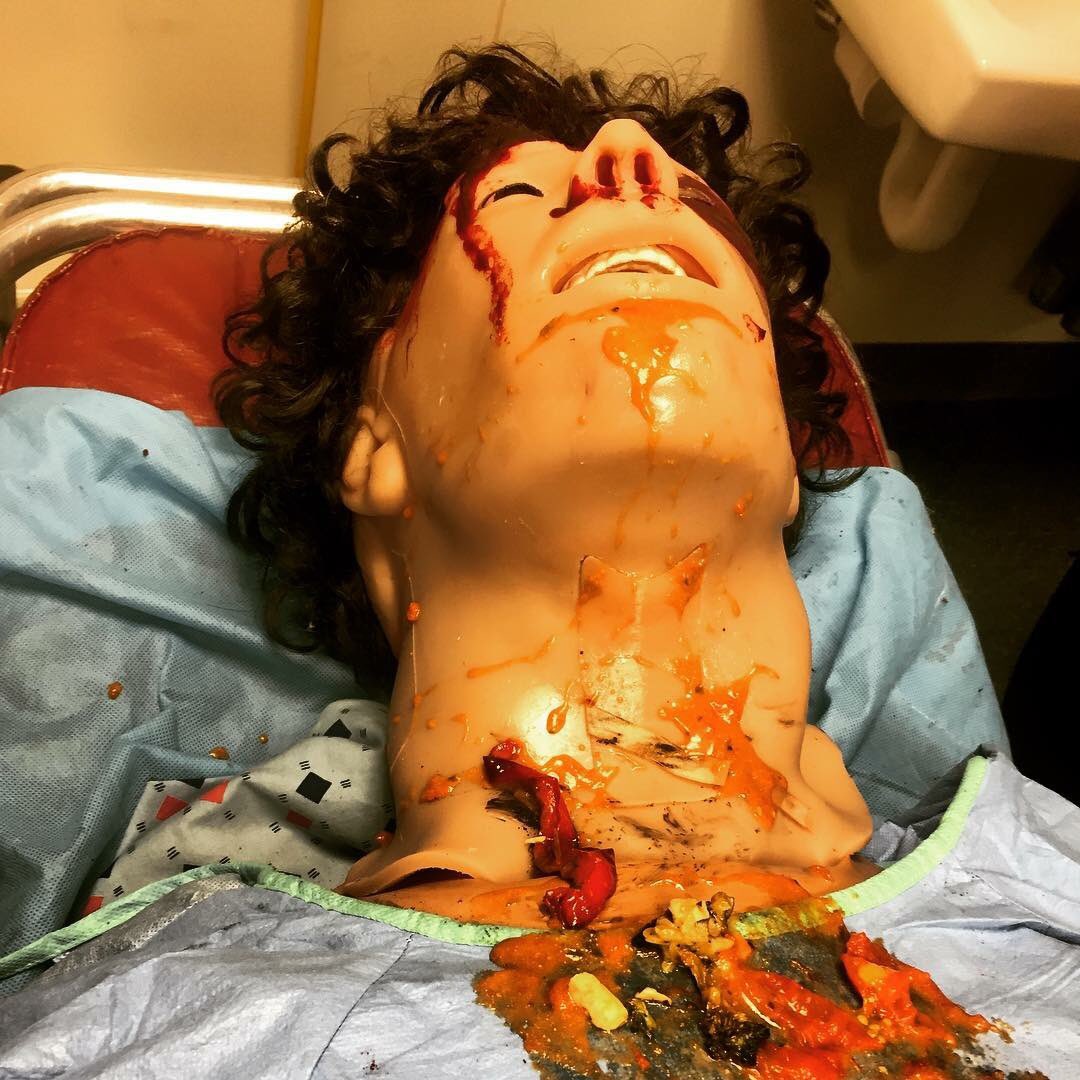 digenakis's tweet image. I had a great night helping out at @PCOM_EMIG sim lab! We focused on trauma, flail chest and head bleeds. #EMclub #spreadingtheknowledge #epiduralhematomas #ams #flailchest